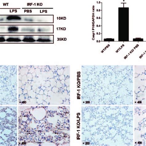 Irf Deletion Attenuates Pyroptosis In Alveolar Macrophages During