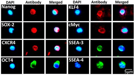 SBSCs stained for embryonic stem cell markers. Representative 400× ...