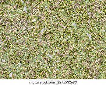 Freshwater Unicellular Green Algae Under Microscope Stock Photo ...