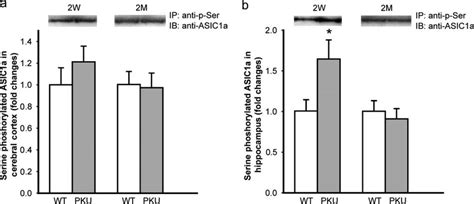 The Level Of PSer ASIC1a In The Brain Of 2W And 2M WT And PKU Mice A