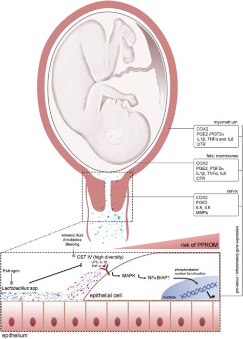 Vaginal Microbiome In Preterm Rupture Of Membranes Obstetrics And