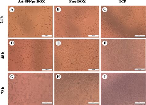 Representative Microscopic Images Showing Cell Morphology Of Mda Mb