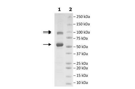 Ezh2 Eed Suz12 His Tag Flag Tag Recombinant