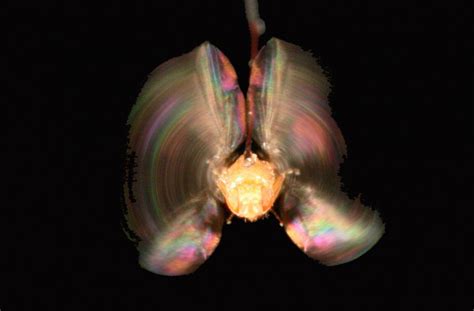 Male Vs Female Stress Responses May Explain Sex Differences In Diseases