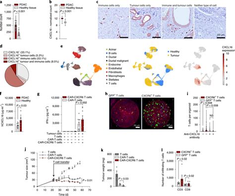 Cxcl Is Expressed By Pdac Specimens And Attracts Cxcr Transduced T