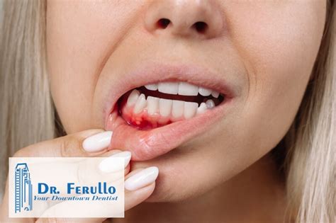 Dr Ferullo Why Are My Gums Bleeding Dr Ferullo