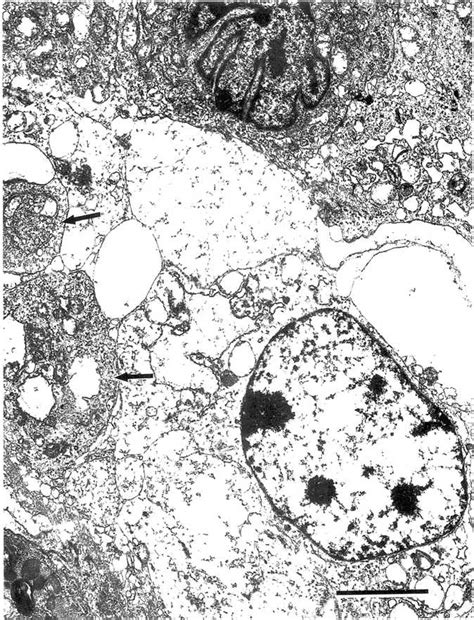 Transmission Electron Micrograph Of Bovine Pulmonary Artery Endothelial