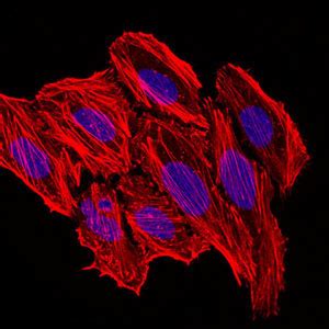 CCL2 Antibody Purified Mouse Monoclonal Antibody WB IHC FC ICC E