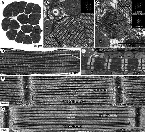 Tymbal and flight muscles. Light ( A and D ) and electron micrographs ...