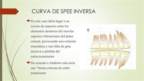 DR ANDREWS Y LAS 6 LLAVES DE OCLUSION Pdf