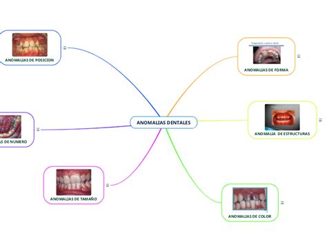 Anomalias Dentales Mind Map