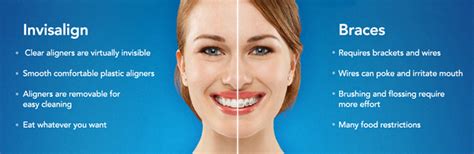 Invisalign Tm Clear Aligners Orthodontist In Kissimmee St Cloud