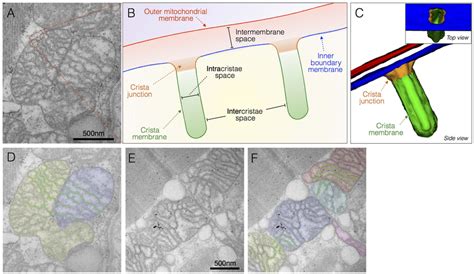 Normal Mitochondrial Ultrastructure A Transmission Electron Download Scientific Diagram