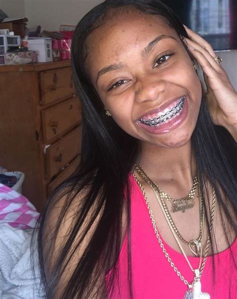 Pin By Brianna Lí🦋 On •braceface• Cute Braces Braces Colors Cute