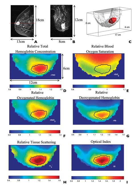 Optical Imaging Of The Breast Basic Principles And Clinical