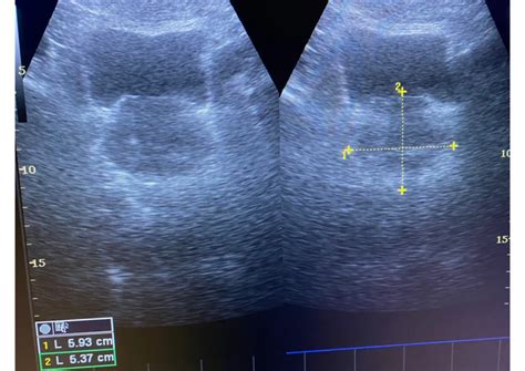 Ultrasonido Testicular Precio En Salud Digna Citas