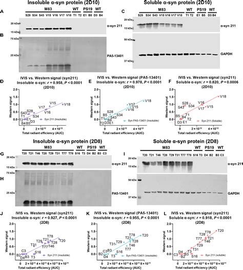 Single Domain Antibodybased Noninvasive In Vivo Imaging Of α Synuclein