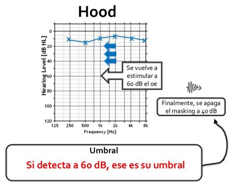 Enmascaramiento Audiolog A Did Ctica Para Estudiantes