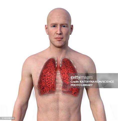 Smokers Lungs Illustration High Res Vector Graphic Getty Images