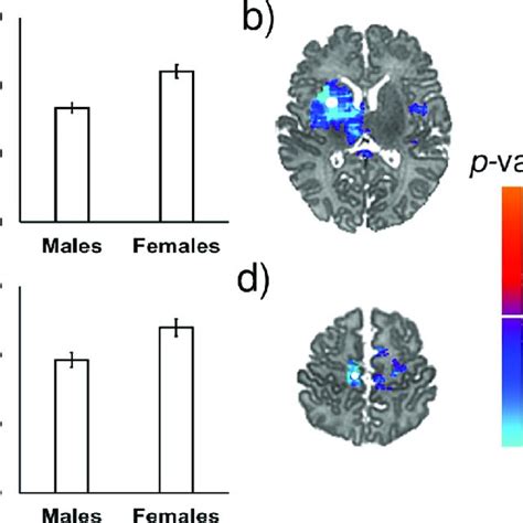 Bar Graphs Showing Sex Differences In Naa Concentrations In The Healthy Download Scientific