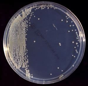 Environmental Isolate Case File: Cronobacter sakazakii – Microbiologics Blog