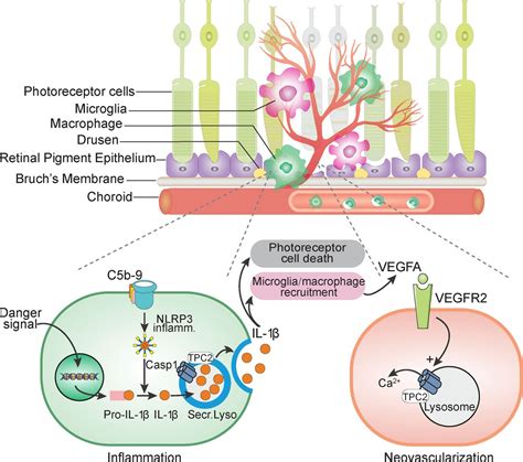 Tpc Promotes Choroidal Angiogenesis And Inflammation In A Mouse Model