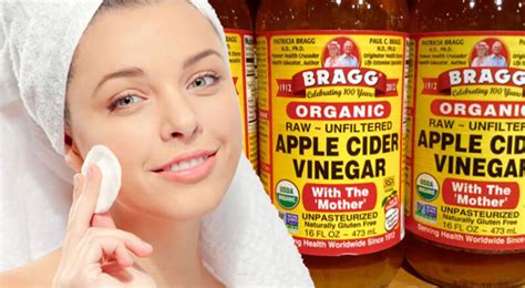 Free 62 Benefits Of Apple Cider Vinegar With Mother 2020 Nogii