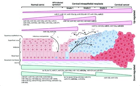 Survey Of Dysregulated Mirnas In The Different Stages Of Cervical