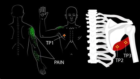 Teres Major Exercises