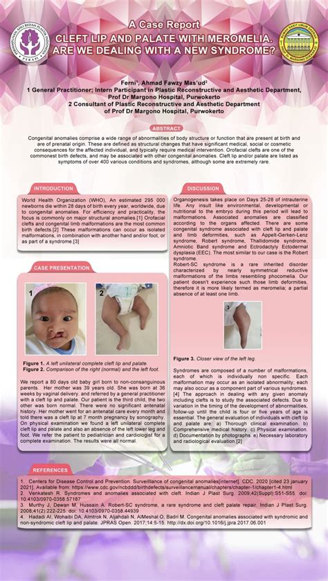 Pdf Cleft Lip And Palate With Meromelia Are We Dealing With A New