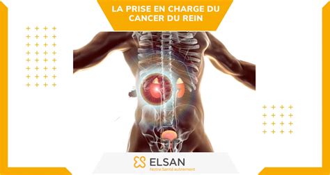 Cancer du rein points clés diagnostic et traitements