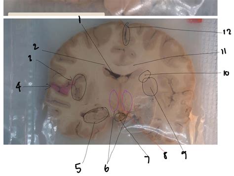 coronal view  diagram quizlet