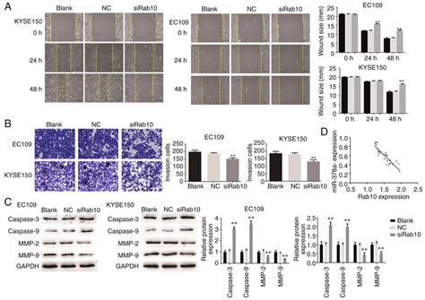 Downregulation Of Rab10 Inhibits Escc Cell Line Invasion And Migration Download Scientific