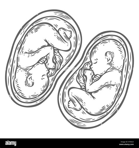 Human Twins Fetus Concept Hand Drawn Vector Illustration Prenatal