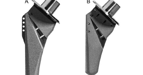 UW Shoulder And Elbow Academy Stress Shielding Component Positioning