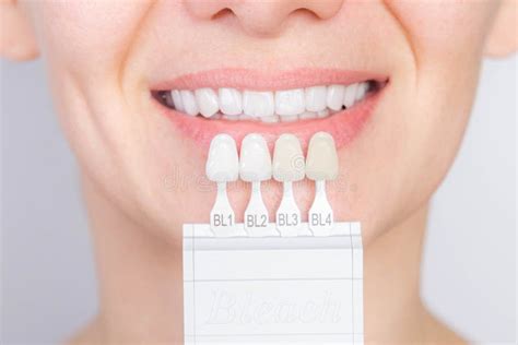 Perfect White Smile With Shade Guide Bleach Color Tooth Dental