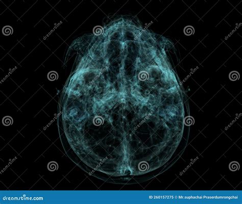 Human Skull Brain By Ct Scan X Ray Visualization Inside Of Skull D