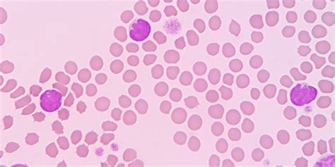 Red Blood Cell Morphology – Vetcetera