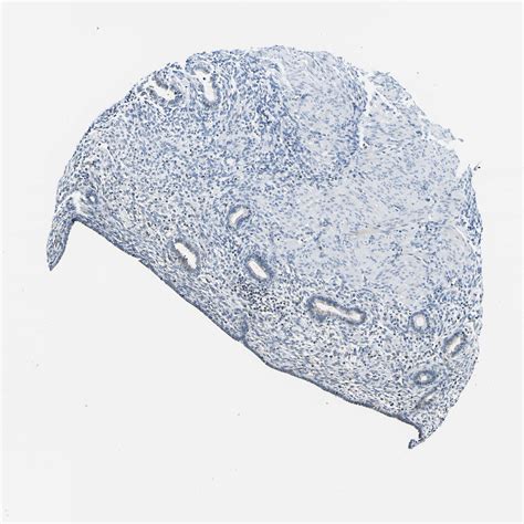 Tissue Expression Of Nlrp Staining In Endometrium The Human