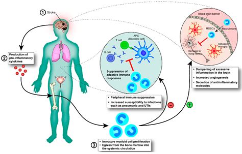 Ijms Free Full Text Innate Immunity And Inflammation Post Stroke