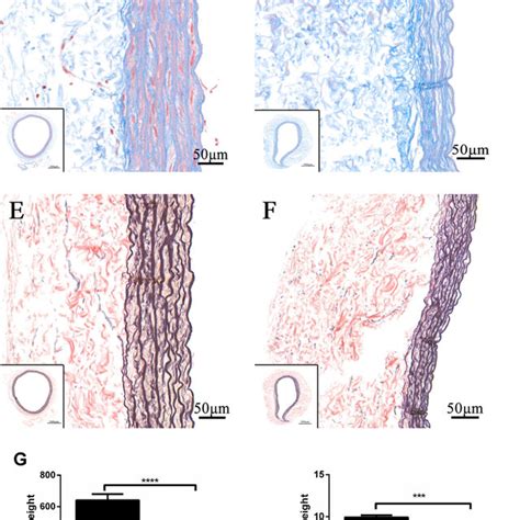 The Staining Results Of Native And Decellularized Blood Vessels A