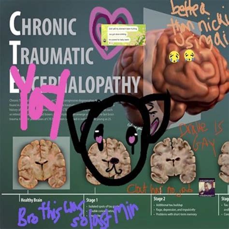 NICKI MINAJ PORN Explicit By JJK FAM On Amazon Music Amazon