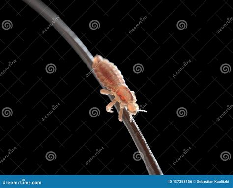 Head Louse Life Cycle Stock Photo | CartoonDealer.com #46581414