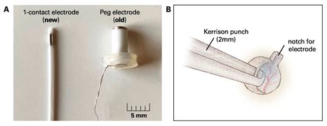 Micromachines Free Full Text Utilization Of Epidural Electrodes As A Diagnostic Tool In