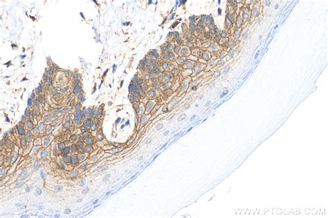 Cd44 Antibody 15675 1 Ap Proteintech 武汉三鹰生物技术有限公司