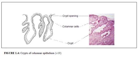 Colposcopy And Treatment Of Cervical Intraepithelial Neoplasia A Beginners’ Manual