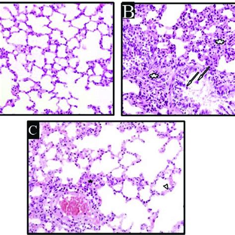 Photomicrographs Of H And E Stained Lung Sections Of Different Groups