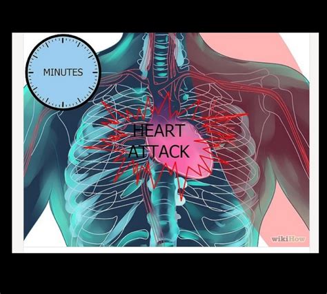 Voici Comment Reconnaître Une Crise Cardiaque Un Mois Avant Quelle Arrive