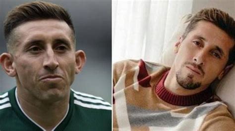 H Ctor Herrera Antes Y Despu S De Su Llamativa Operaci N Est Tica