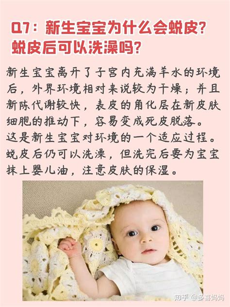 新生儿皮肤护理 知乎